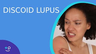 Discoid Lupus  Daily Dos of Dermatology [upl. by Ahsinrac]