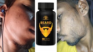 Permanent Beard Growth Results  Redensyl Beard Growth Serum  Best Beard Oil 2023 [upl. by Ahsineg984]