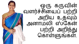 ஒரு கருவின் வளர்ச்சியைப் பற்றி அறிய உதவும் அனாமலி ஸ்கேன் பற்றி அறிந்து கொள்ளுங்கள் [upl. by Arihsaj]