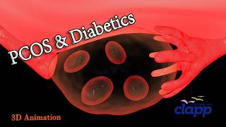 PCOS AND DIABETICS  3D Animation [upl. by Abekam]