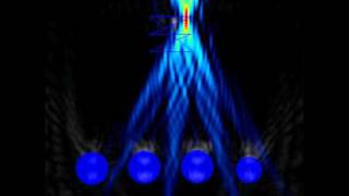 Electronically Scanned Ultrasound Phased Array [upl. by Kassia8]