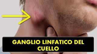 CRECIMIENTO DE GANGLIOS LINFÁTICOS EN LA REGIÓN DEL CUELLO ¿CAUSAS Y TRATAMIENTO [upl. by Cud294]