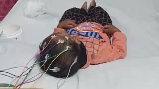 16 CHANNEL EEG TEST CHILD  how to do EEG  EEG tutorial tutorial electroencephalography [upl. by Releehw576]