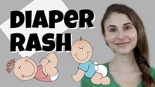 DIAPER RASH TIPS amp TRICKS FROM A DERMATOLOGIST DR DRAY [upl. by Shelia]