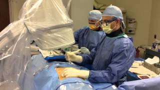 Kyphoplasty Procedure Part 1 – Parkway Surgery Center [upl. by Clougher]