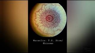 Pteridophyta  Marsilea Permanent Slides of StemRhizome and Sporocarp [upl. by Sascha]