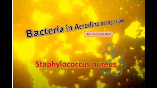 Staphylococcus aureus under Fluorescence microscopy [upl. by Angeli]