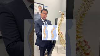 STRUGGLING WITH KYPHOSIS LEARN THE BEST TREATMENTS FOR A HUMPBACK  SPINE SURGEON  ALLIANCE ORTHO [upl. by Ddahc]