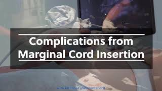 Marginal Umbilical Cord Insertion [upl. by Odelinda]