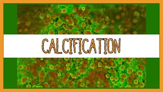 Dystrophic vs Metastatic Calcification [upl. by Tut]