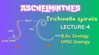 Aschelminthes  Trichinella spiralis Parasitic helminthes  Zoology  Notes in Description [upl. by Eniaral]