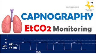 Capnography  ETCO2 Monitoring [upl. by Balbur230]