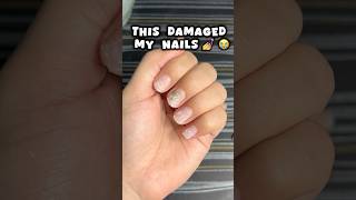 Nail extensions ki galti 😭😭nails nailsextension viralvideo shortsfeed viralshort trending [upl. by Enajaras860]