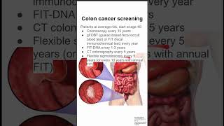 Colon cancer screening [upl. by Tirreg869]