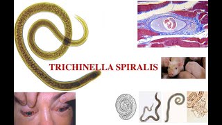 Triquinella spiralis [upl. by Mycah]