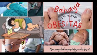 Bahaya Obesitas [upl. by Coulombe]