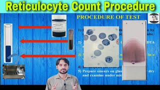 Reticulocyte Counting Procedure [upl. by Willmert]