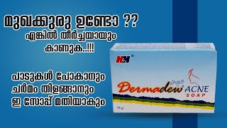 മുഖക്കുരു പാടുകൾ പോകാൻ ഒരു സോപ്പ്  Derma Dew Acne Soap Honest Review [upl. by Ettenwad101]