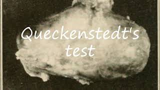 How to Pronounce Queckenstedts test [upl. by Airtemad]