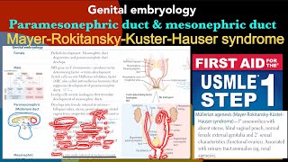 Genital embryology Male amp Female development ￼ Mullerian agenesis in HindiUrdu by USMLE step 1 [upl. by Audley]