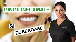 Gingii inflamate si dureroase cauze si solutii  Clinicile Dentare Dr Leahu [upl. by Narcis]