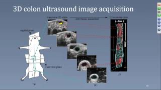 March 2017 Assessment of Murine Colorectal Cancer by UHF Ultrasound using 3D Reconstruction [upl. by Streeto24]