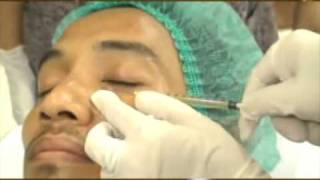 PRP Plateletrich plasma Treatment for Rejuvenation [upl. by Ahtiuqal]