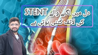 Angioplasty Stent ki Life kitni Hoti ha How Long do stent last Stent life in heart [upl. by Incrocci666]