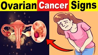 9 Common Ovarian Cancer Signs That You Should Never Ignore [upl. by Ecinehs]