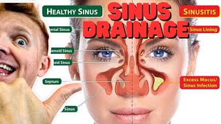 Natural sinus drainage swollen lymph nodes blocks the passage tutorial [upl. by Nylazor232]