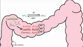 Hepatic Encephalopathy and Lactulose [upl. by Walther]