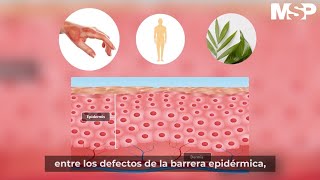 ¿Qué es la dermatitis atópica [upl. by Ennoved]