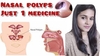 Homeopathic medicine for nasal polyps [upl. by Naeroled]