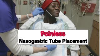 Painless Nasogastric Tube Placement [upl. by Arualana373]