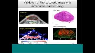 October 2015 Webinar  Clinically Translatable Cancer Research with Photoacoustic Imaging [upl. by Ettenna]