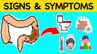 Diverticulitis  You Need To Know These Signs And Symptoms [upl. by Assenal]