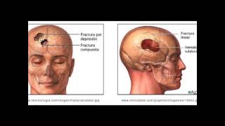 Flujo sanguineo cerebral liquido cefalorraquideo y metabolismo cerebral PARTE 3 [upl. by Val]