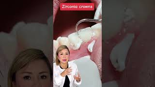 ¡Renovando sonrisas con coronas de zirconio 🦷💎 [upl. by Llacam]