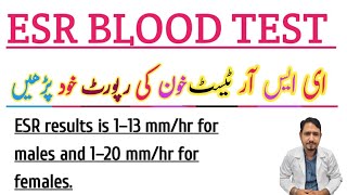 ESR BLOOD TEST Urdu Hindi Irfan Azeem [upl. by Eiramik744]