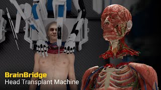 Head Transplant Machine – BrainBridge [upl. by Ahseekat]