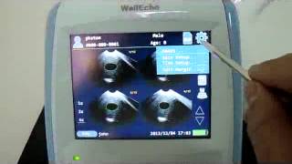 Carescan1 Bladder Scanner Operation part 2 [upl. by Kallman133]