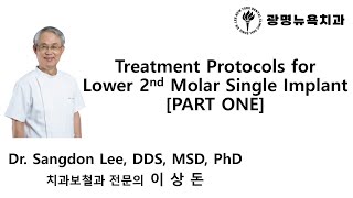 Treatment Protocols for Lower 2nd Molar Single Implant PART 1 [upl. by Aivil]