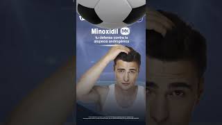 Para ganarle a la alopecia usa Minoxidil MK [upl. by Einatirb]