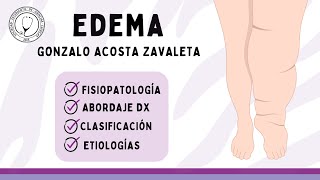 EDEMA Fisiopatología Abordaje diagnóstico Clasificación y Etiologías  Semiología [upl. by Serdna]