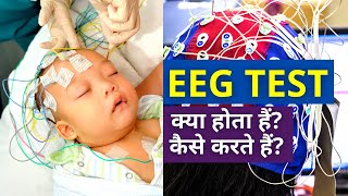 EEG Test for Brain in Hindi  EEG Test क्या होता हैं कैसे करते हैं [upl. by Allegna25]