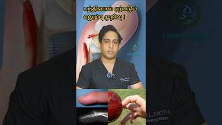 கிரிக்கெட் பந்தினால் ஏற்படும் எலும்புமுறிவுFinger fracture while catchingMallet Finger treatment [upl. by Alvy]