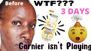 GARNIER VITAMIN C 🍋SERUM REVIEWRESULTS IN THREE🤔🤯 DAYS IS GARNIER FOR REAL [upl. by Triley]