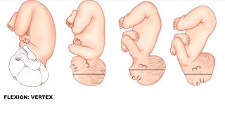 Fetal Skull Diameters Made Easy  Obstetrics [upl. by Solokin415]