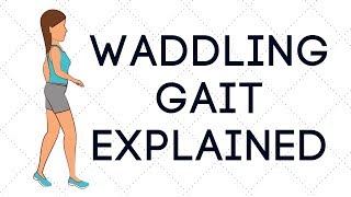 Waddling Gait Explained [upl. by Eirollam]