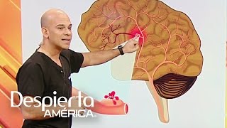 ¿Cómo detectar las señales de un aneurisma cerebral [upl. by Parnas]